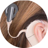 IMPLANTABLE MEDICAL DEVICES