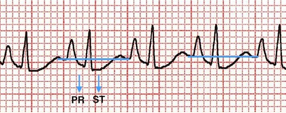 ECG Sensors for doctors
